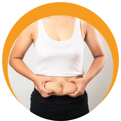 Tummy Tuck