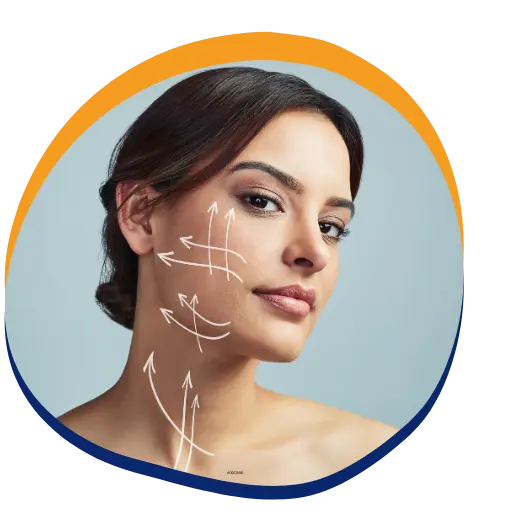 Facelift